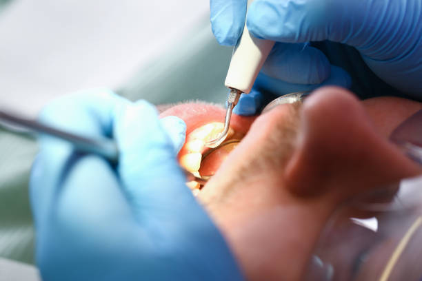 Best Emergency Dental Care for Sports Injuries in West Wyomissing, PA