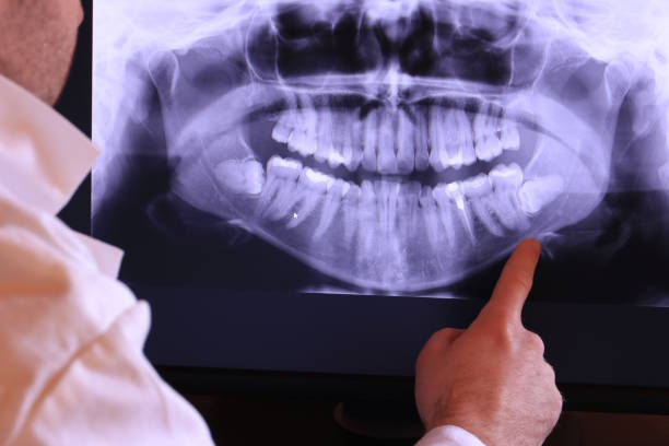 Best Emergency Care for Gum Disease in West Wyomissing, PA