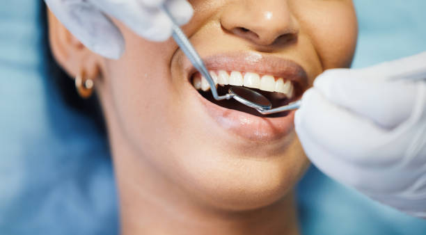 Best Dental Abscess Treatment in West Wyomissing, PA